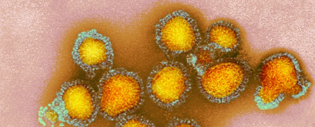 Influenza Type A