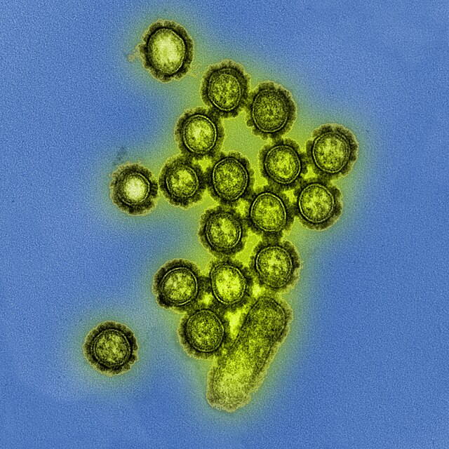 H1N1 Influenza virus