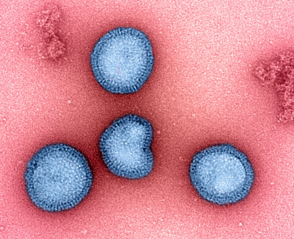 Influenza Type B