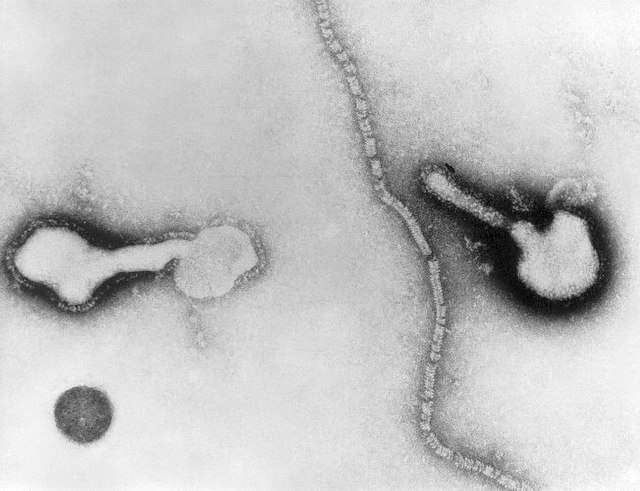 Transmission electron micrograph of parainfluenza virus.